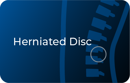herniated disc